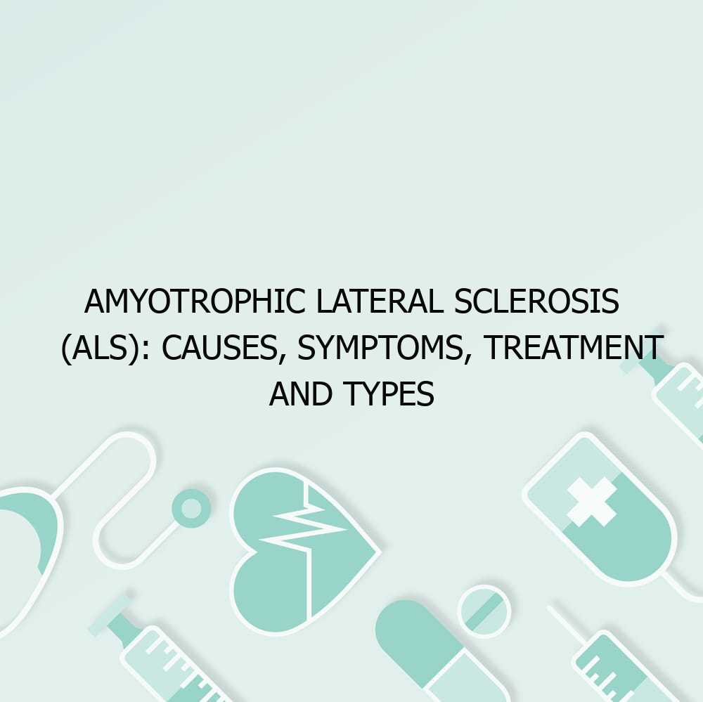 Amyotrophic Lateral Sclerosis (ALS): Causes, Symptoms, Treatment and Types