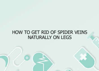 How to Get Rid of Spider Veins Naturally on Legs