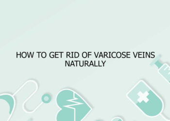 How to Get Rid of Varicose Veins Naturally